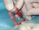 Классическая стерилизация