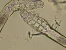 Demodex canis