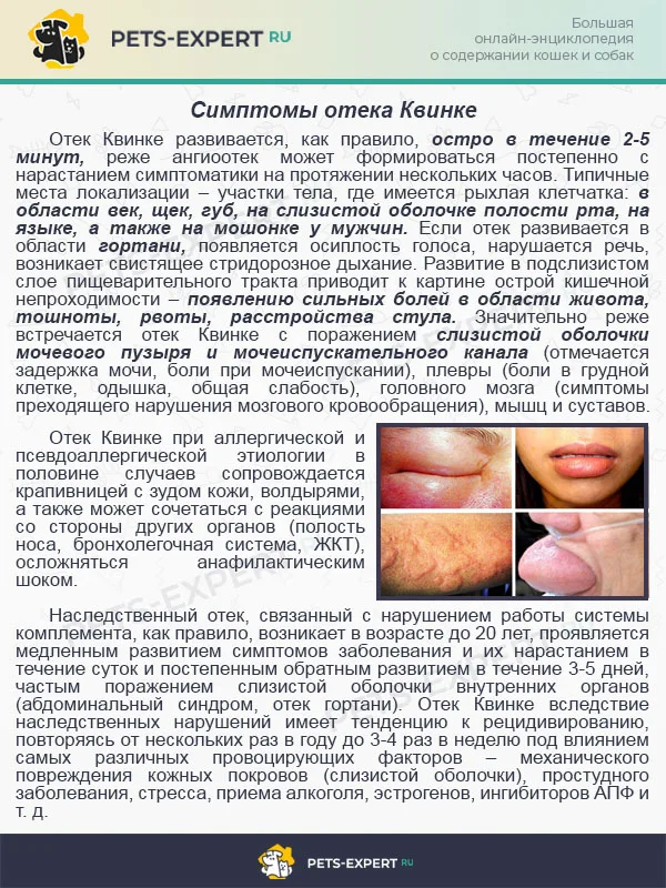 Симптомы отека Квинке