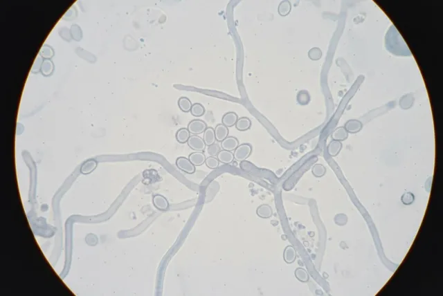 Гриб Candida albicans под микроскопом