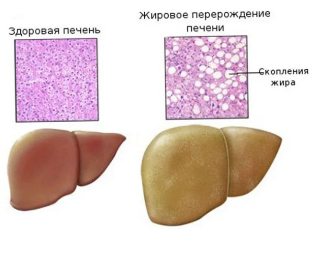 Жировое поражение печени у собак