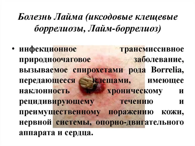 Описание болезни Лайма