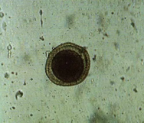 Яйцо Toxacara canis