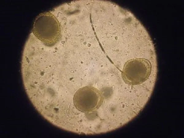 Яйца Toxocara cati