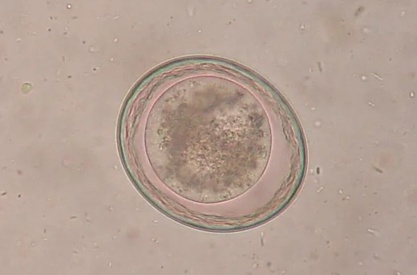 Яйца Toxocara leonina