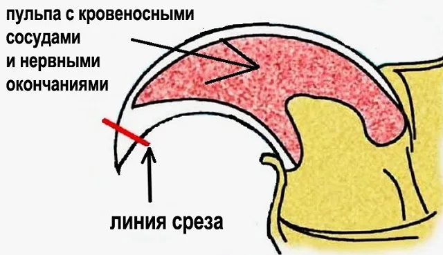 Собачий коготь в разрезе