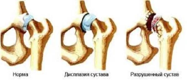 Проявление дисплазии у кошек