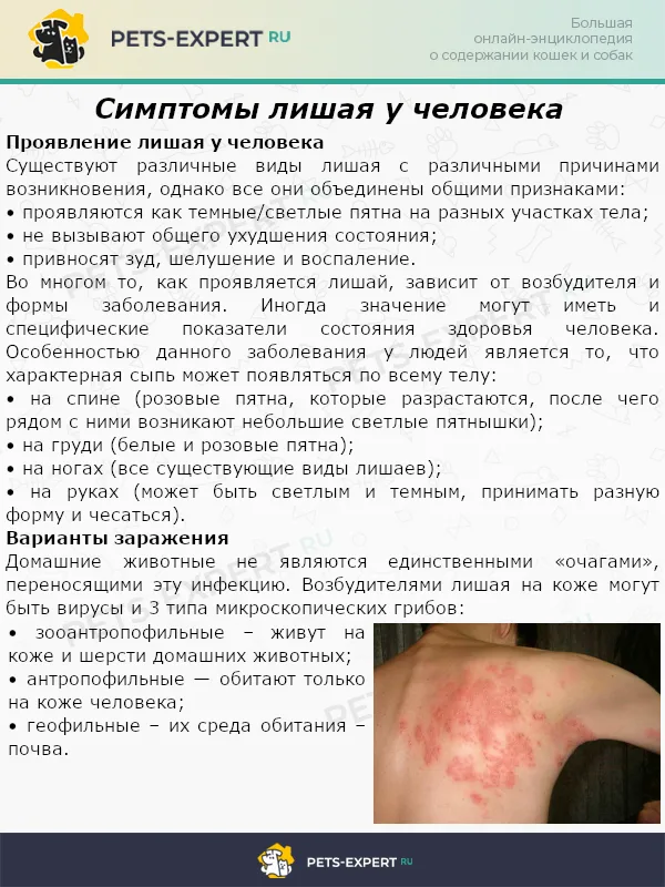Симптомы лишая у человека