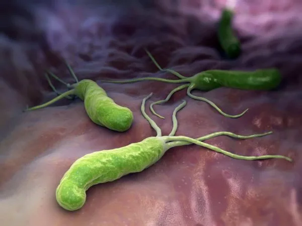 Деятельность Helicobacter pylori приводит к появлению гастрита