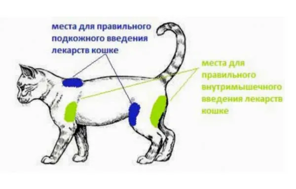 Схема мест на теле для внутримышечных и подкожных уколов