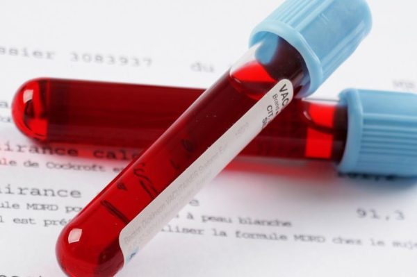 Чтобы диагностировать животному анемию и выяснить её тип, необходим клинический анализ крови