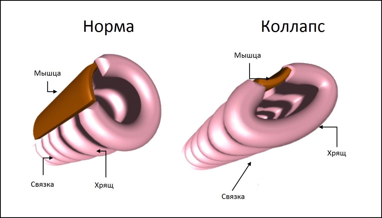 Почему собака кашляет как будто подавилась, Чихуахуа кашляет как будто подавилась пытается что-то отрыгнуть