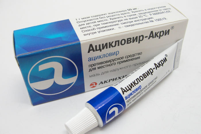Мазь Ацикловир позволит снять воспаление с пораженного участка