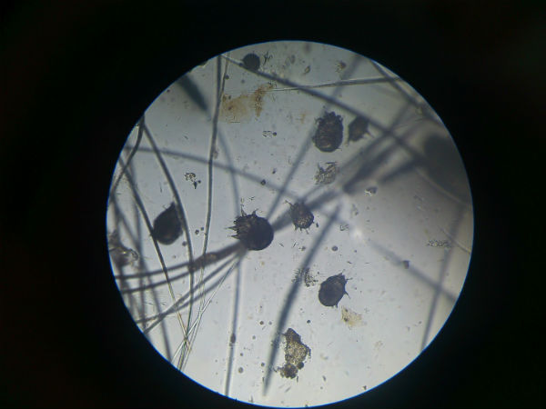 Чесоточные клещи под микроскопом