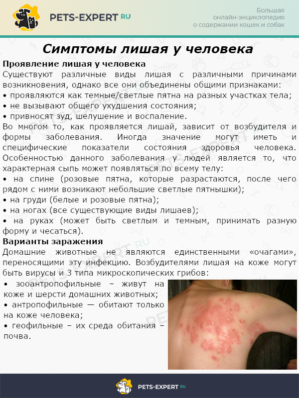 Симптомы лишая у человека