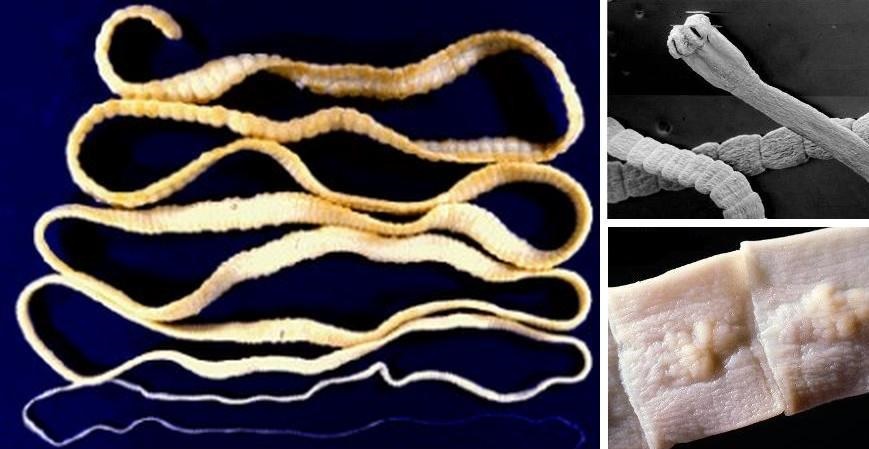 Глисты - кишечные черви, проживающие в желудочно-кишечном тракте