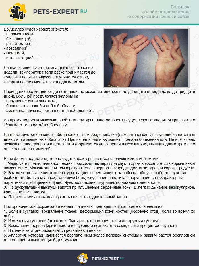 Симптомы бруцеллеза у человека