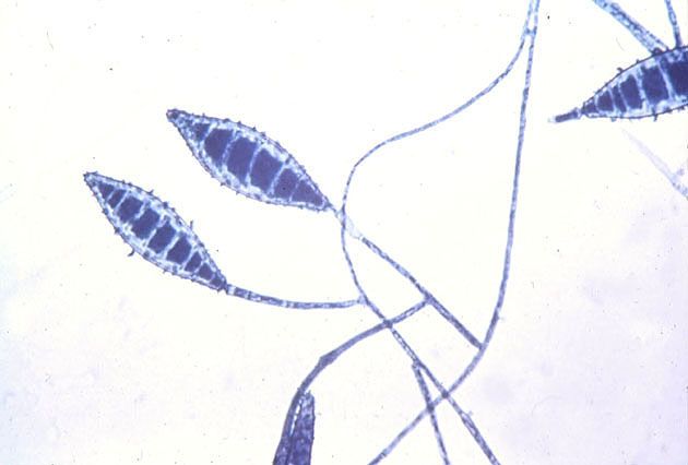 Лишай вызывают грибки рода Trichophyton и Microsporum