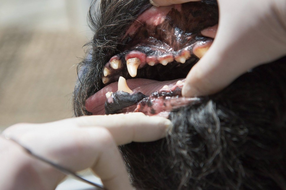 Пульпит приводит к быстрому разрушению структуры зуба
